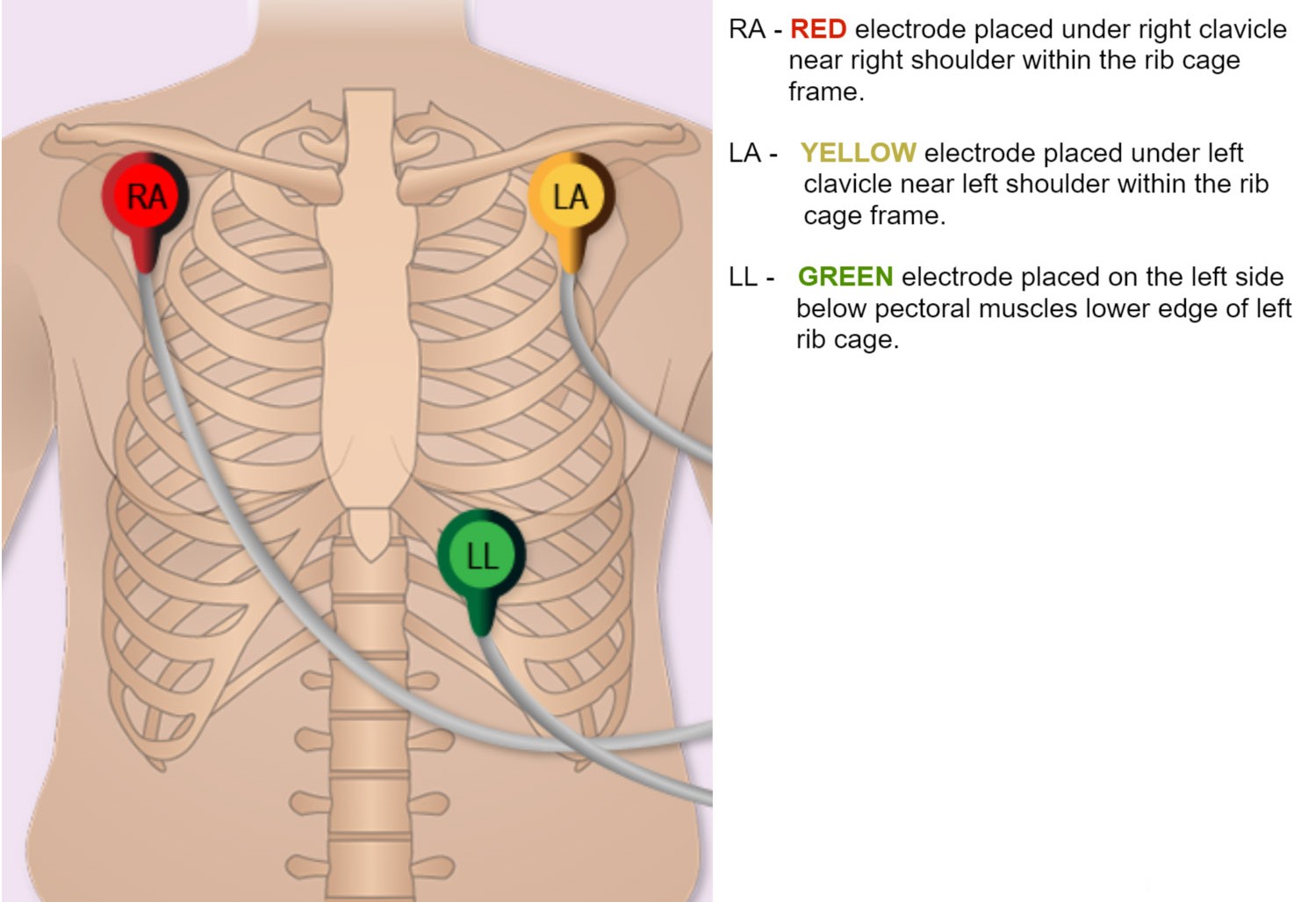 3 Lead ECG Setup