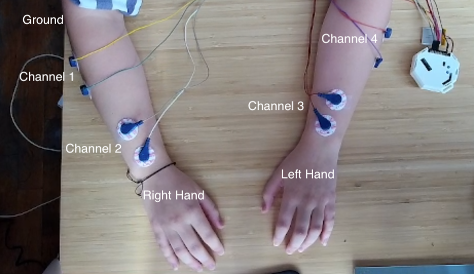 Electrode Placement Diagram